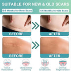 Silicone Scar Remover Tape for Acne & Wrinkles