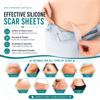 Silicone Scar Remover Tape for Acne & Wrinkles