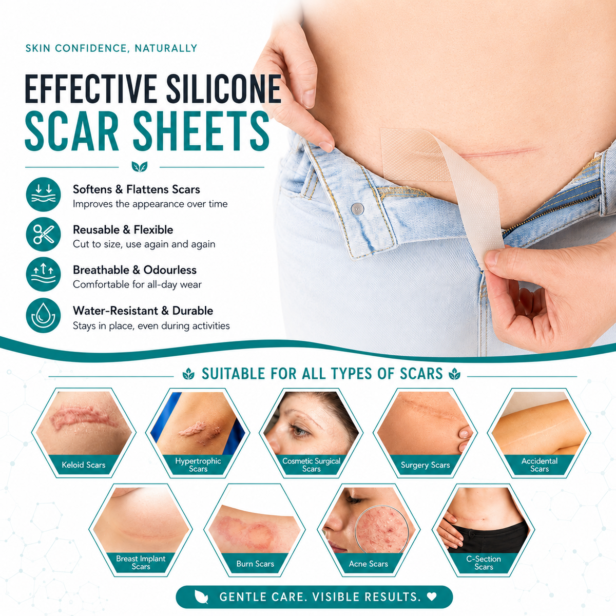 Silicone Scar Remover Tape for Acne & Wrinkles