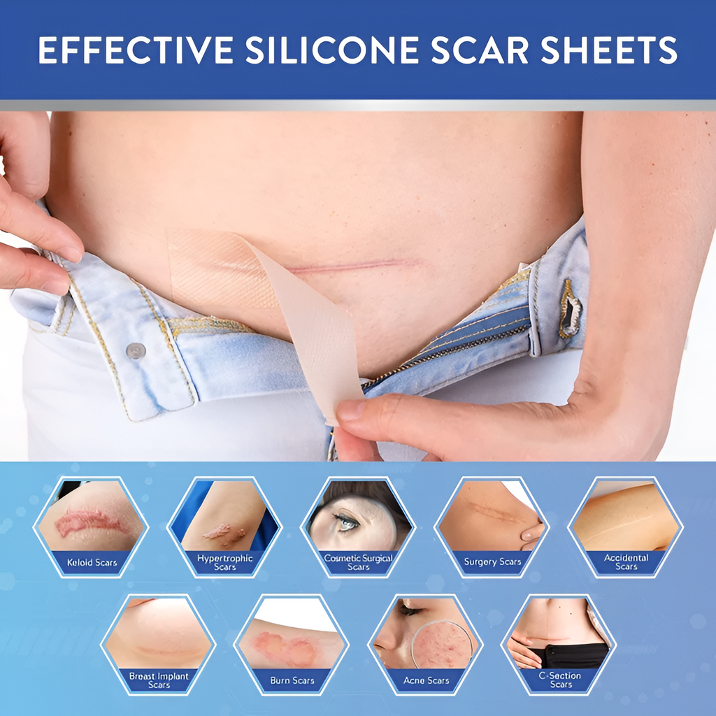 Silicone Scar Remover Tape for Acne & Wrinkles