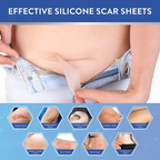 Silicone Scar Remover Tape for Acne & Wrinkles